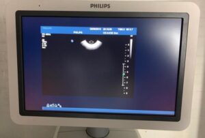 2008 Philips iU22 Ultrasound Machine 2