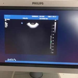 2008 Philips iU22 Ultrasound Machine 2