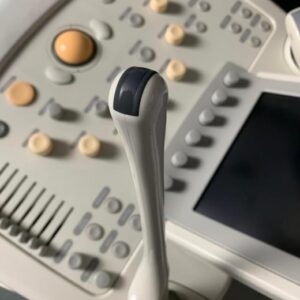 2008 Philips iU22 Ultrasound Machine 7