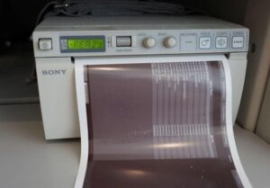 2011 Philips iU22 Ultrasound Machine 8